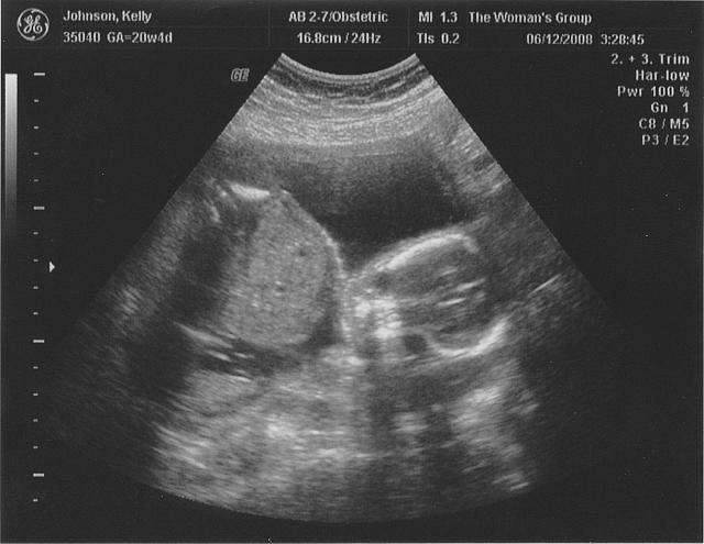 ultrasound_01.jpg