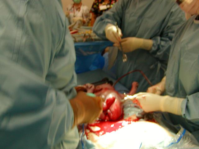 Whoever said the birthing process was beautiful was blind!