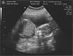 ultrasound_01.jpg