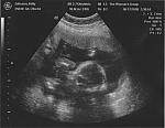 ultrasound_02.jpg